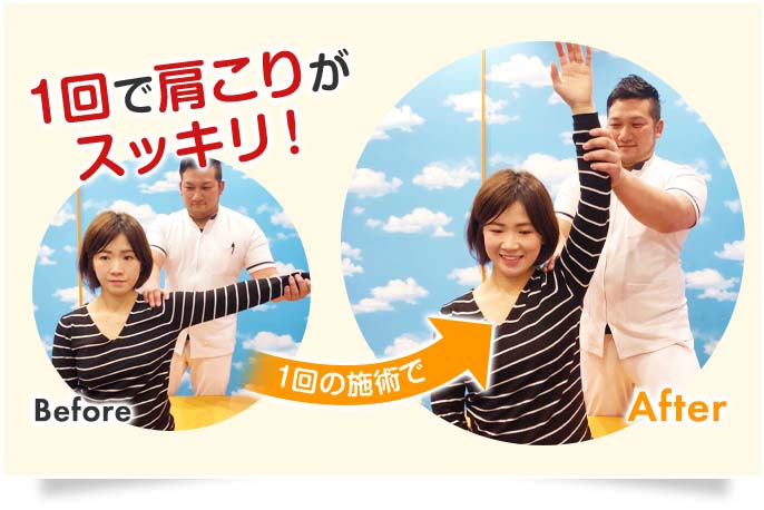 たった1回で肩こりが改善した女性