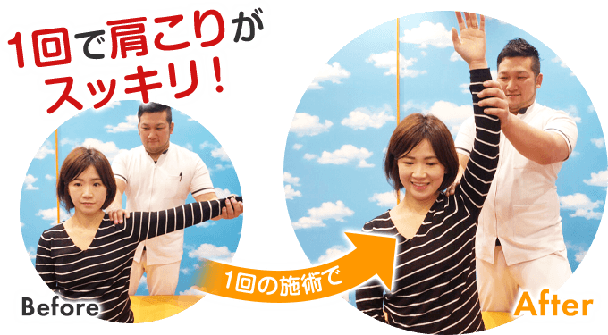 1回で肩こりが スッキリ!Before After