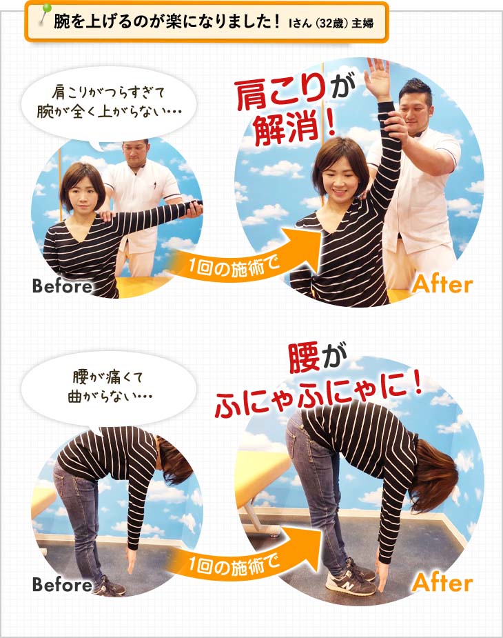 腕を上げるのが楽になりました